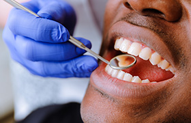 Closeup of patient receivng exam after metal free dental restoration placement