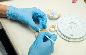 Dental lab creating a bridge