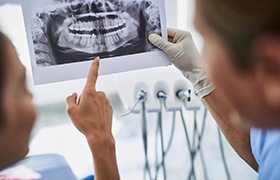 Dental implant dentist in DeLand showing patient an X-ray