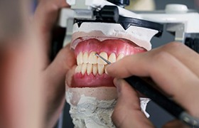 a dental technician using special tools to create dentures