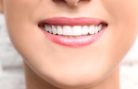 Closeup of a woman’s beautiful smile after dental bonding