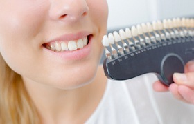 Woman having the shade of her dental bonding determined