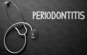 The periodontitis writing on chalkboard next to stethoscope