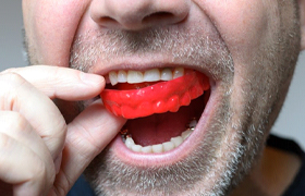 man putting a red mouthguard in his mouth