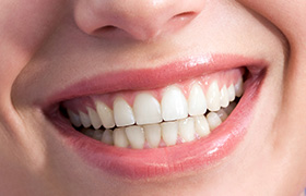 Closeup of teeth with dental sealants