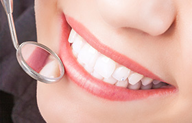 Closeup of flawless smile after fluoride treatment