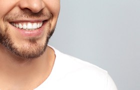 man closeup smile makeover in DeLand