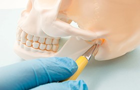 Hand pointing to temporomandibular joint with yellow pen