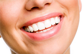 Closeup of woman’s beautiful smile after porcelain veneers