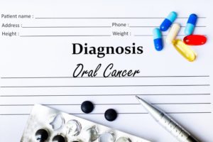 oral cancer diagnosis