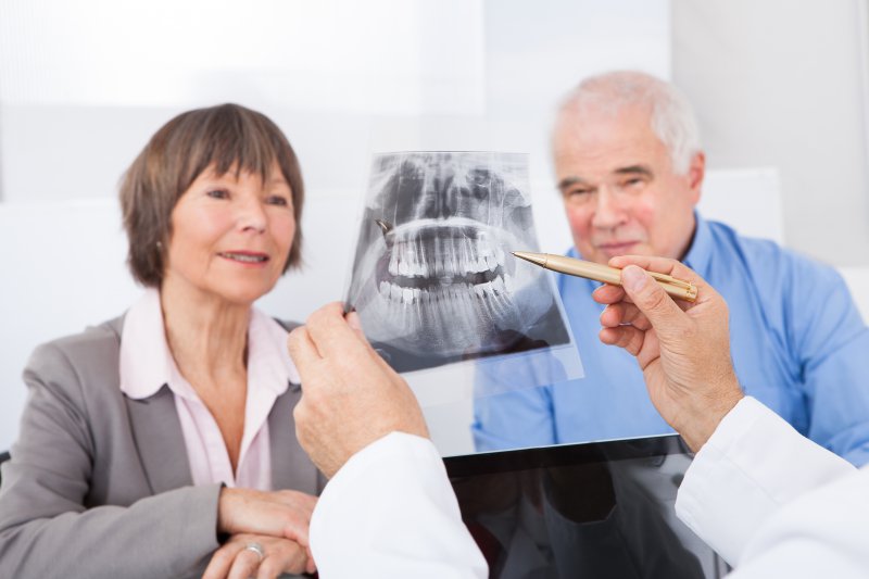 Older couple learning about dental implant myths