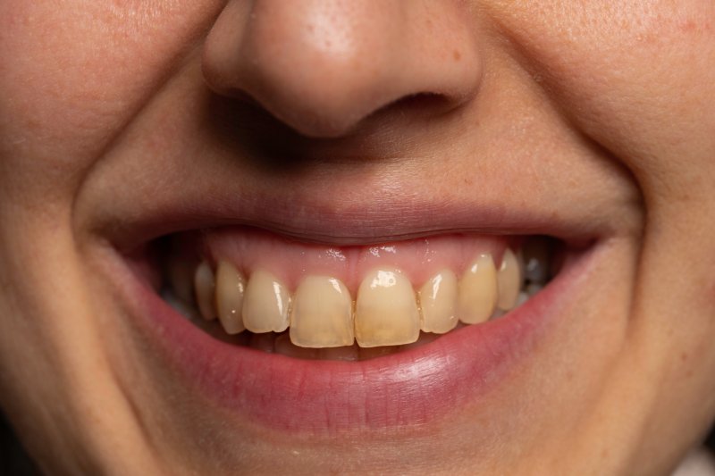 close up of a yellow smile