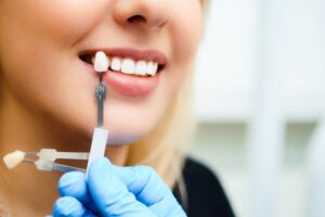 Dentist holding sample veneer to woman's teeth