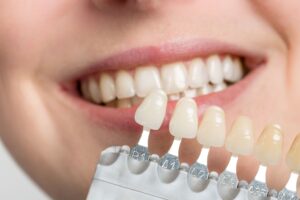 Closeup of sample veneers held up to a smile